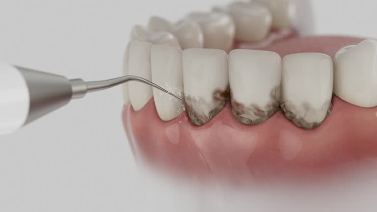Reliable Dental Implants contractor in Tonawanda, NY by Smile Center Dentistry